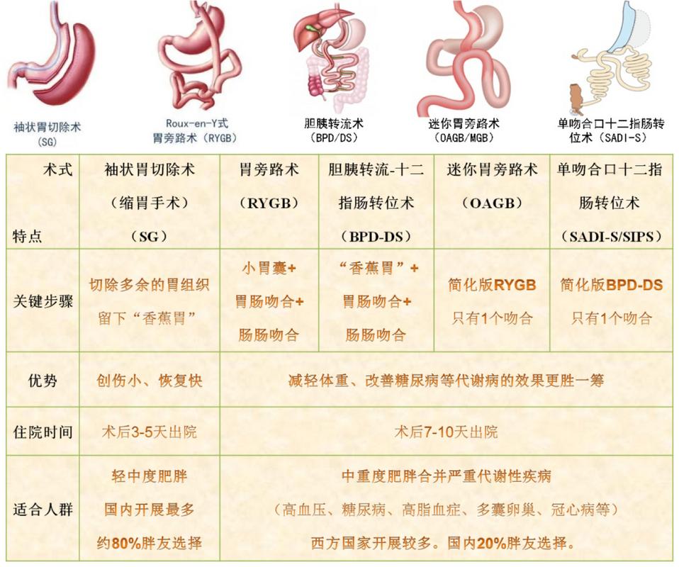 哪种外科三类减肥手术最适合我？