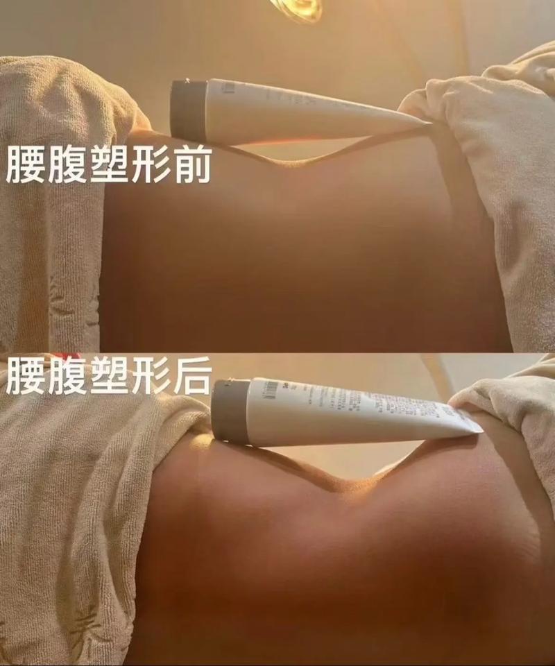 今夏如何通过手术减肥塑身，打造全新形象？