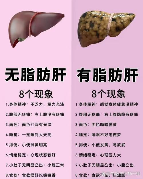 脂肪肝的六个常见误区，你中了几个？