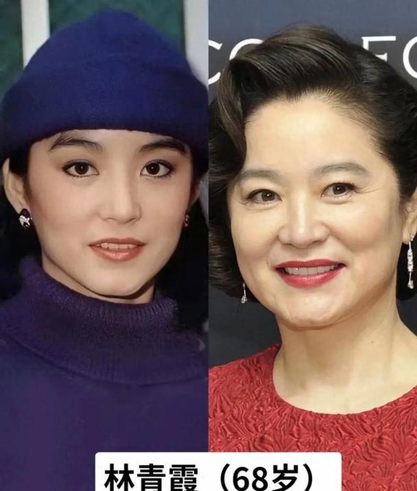 年轻时越漂亮，老了是不是更容易变丑呢？