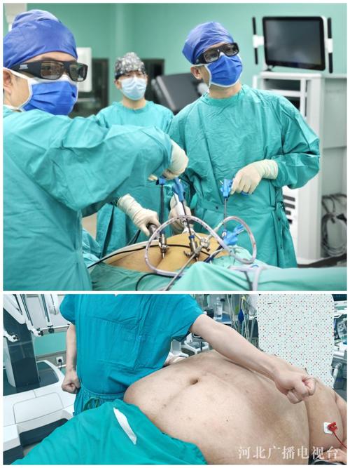 小胖墩整形手术过程和效果如何？