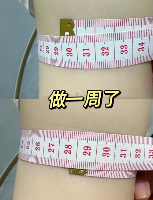 如何通过淋巴按摩有效去除蝴蝶袖，改善手臂线条？