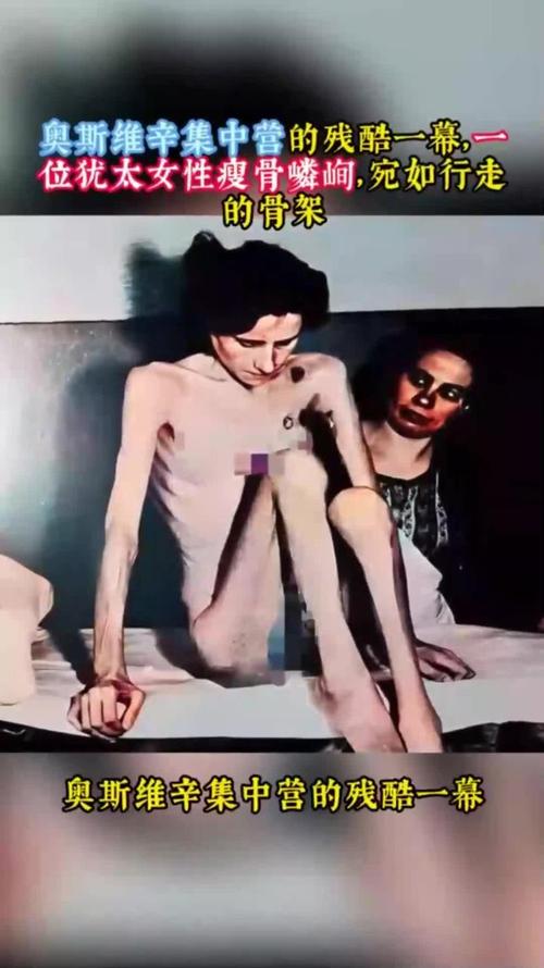 世界上蕞瘦女子减肥后变成了活干尸，这是真的吗？