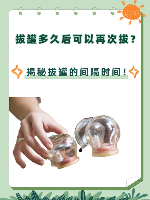 夏日拔罐减肥的时间应该缩短到多久比较合适呢？
