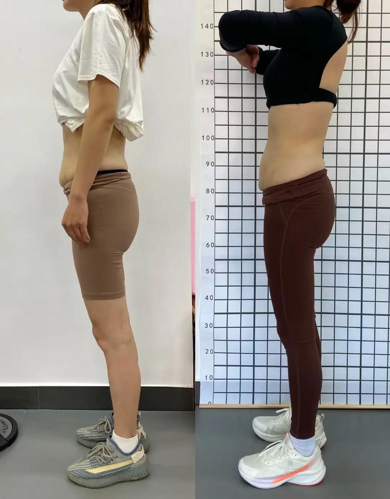 女子快速减肥后皮肤松弛，如何通过举重健身重拾自信？
