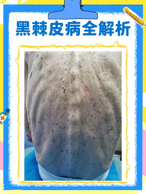 皮肤上有哪些不为人知的惊人秘密？