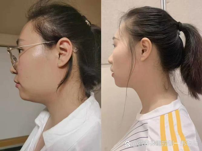 曾为爱增肥的美女子分手后为何能减掉216斤？