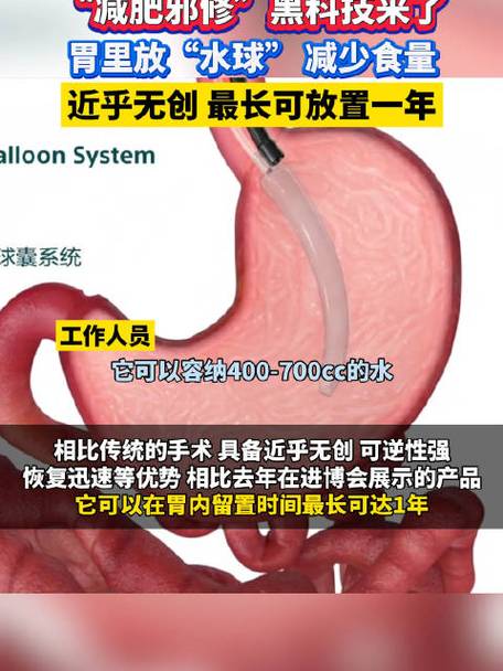 胃内放水囊减肥手术安全吗？