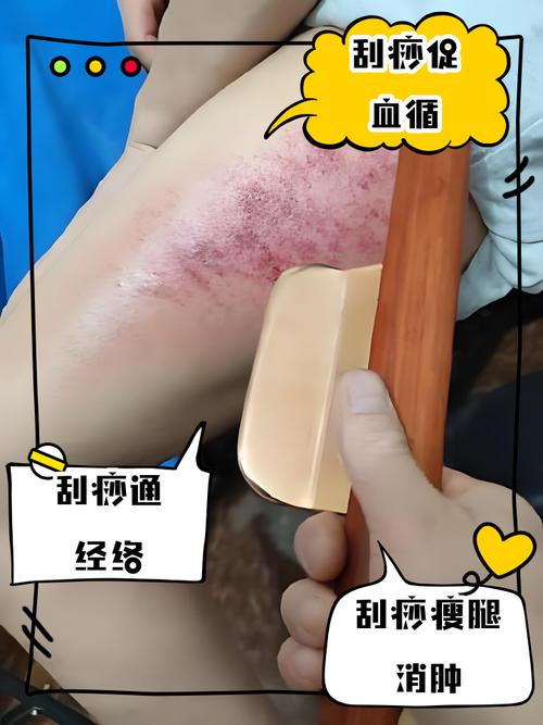 5个局部刮痧减肥法，真的能让全身零脂肪吗？