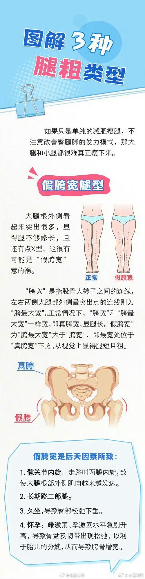 为什么五种走姿既难看又容易让腿变胖？