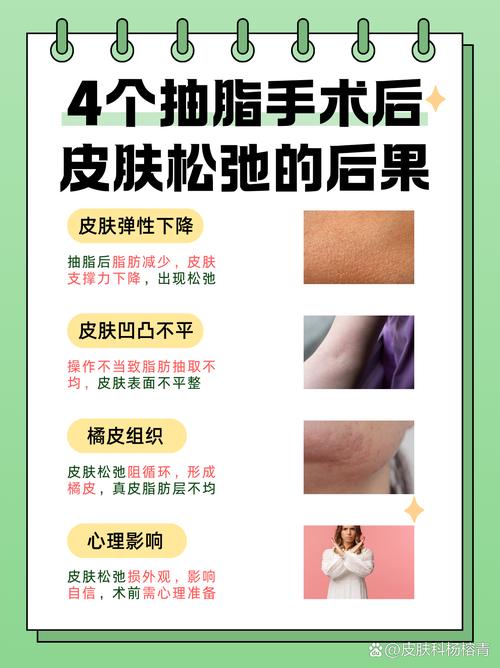 吸脂后皮肤会松弛下垂吗？有没有方法避免？