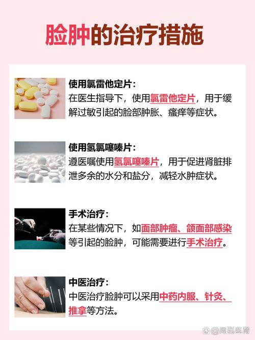 为什么我经常会有脸部浮肿，是不是因为四大坏习惯导致的呢？