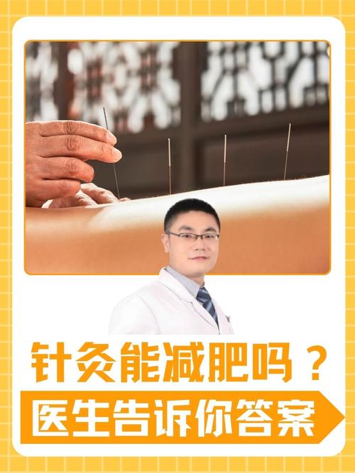针灸减肥一个月能减掉14斤吗？效果如何？