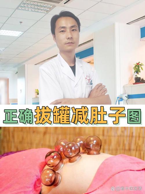 拔罐瘦身法真的能让我减肥吗？中医秘籍效果如何？