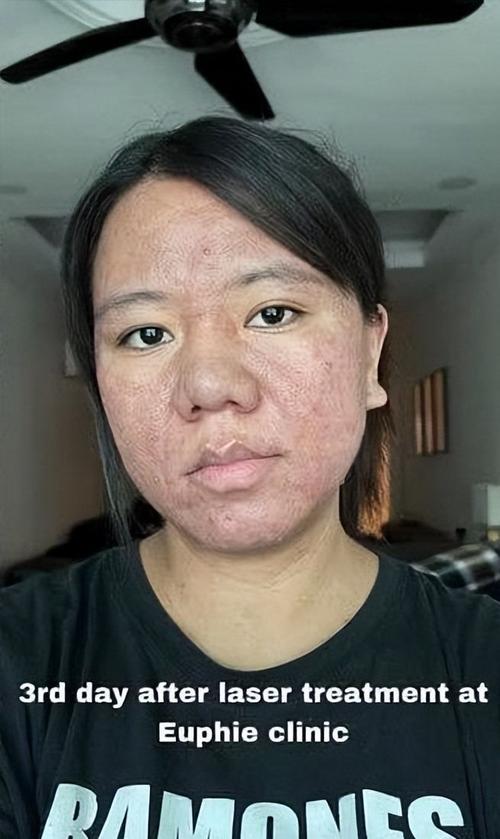 有哪些不良因素会导致女性失去貌美如花的容颜？