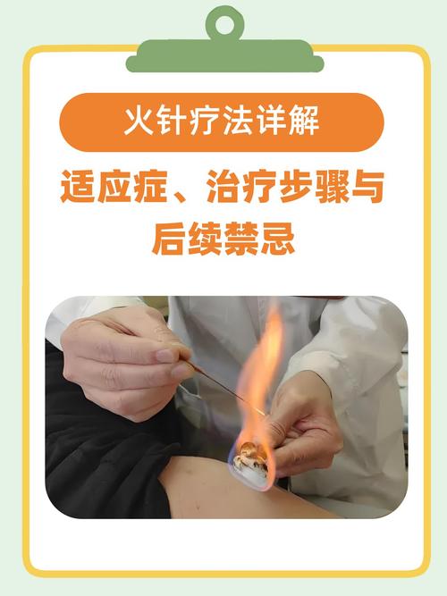 火针疗法是如何通过刺激穴位来达到治疗目的的？