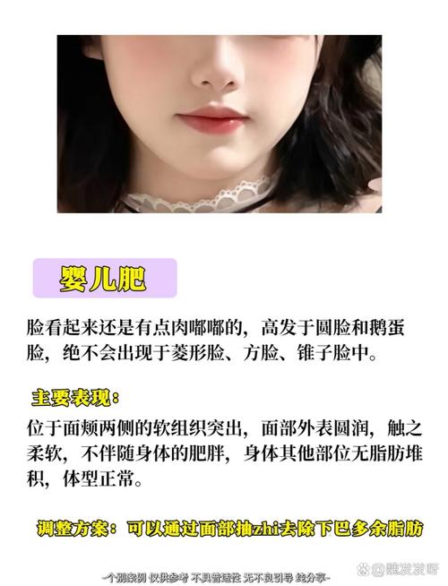 面部吸脂术适合哪些具体人群或情况？