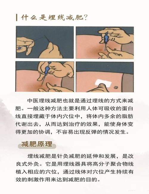 中医埋线减肥法真的能狂减脂吗？这是神奇瘦身新招吗？