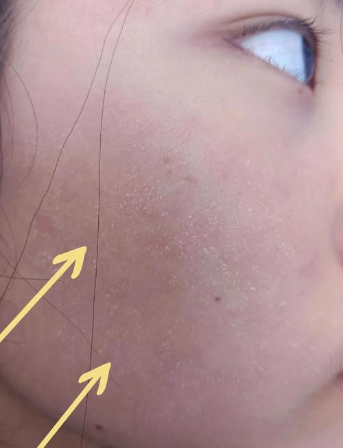 不勤洗脸会导致皮肤变粗糙吗？这样皮肤会变得粗糙吗？