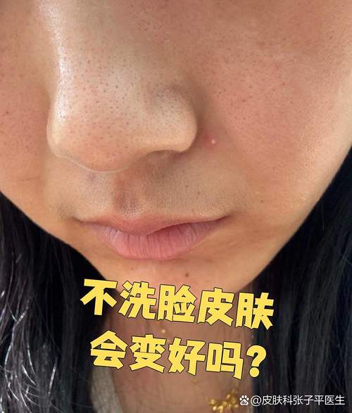 不勤洗脸会导致皮肤变粗糙吗？这样皮肤会变得粗糙吗？