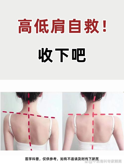 如何通过美肩操塑造V字型香肩？