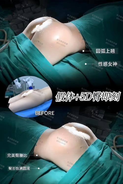 小胖墩整形手术过程和效果如何？