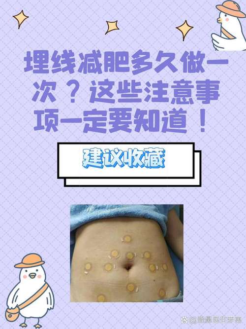 埋线减肥真的靠谱吗？其风险大，我们该如何？