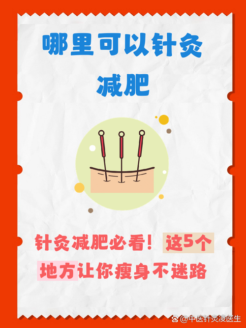 如何挑选优质的针灸减肥医院？