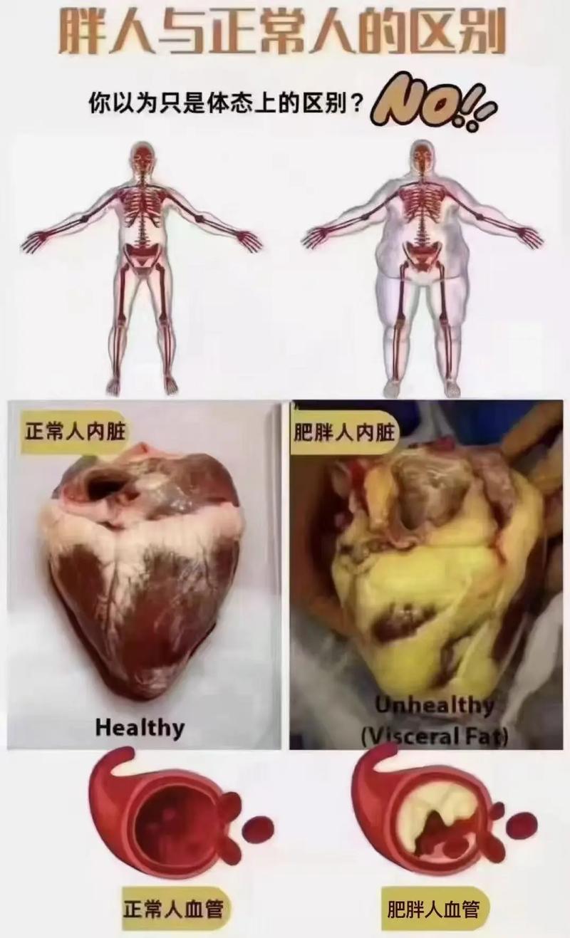 健康胖子真的比健康瘦子更长寿吗？