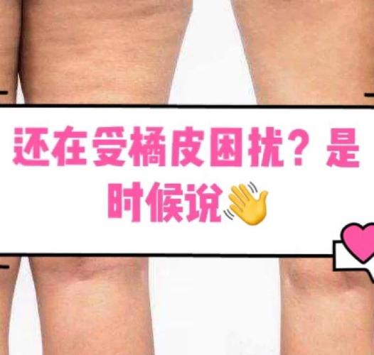如何彻底告别橘皮困扰？