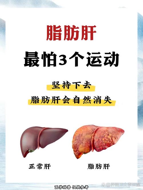 如何正确减肥避免患上减肥型脂肪肝？