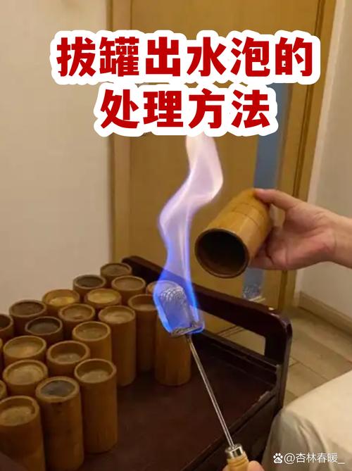 拔罐减肥后皮肤出现水泡应该怎么正确处理？