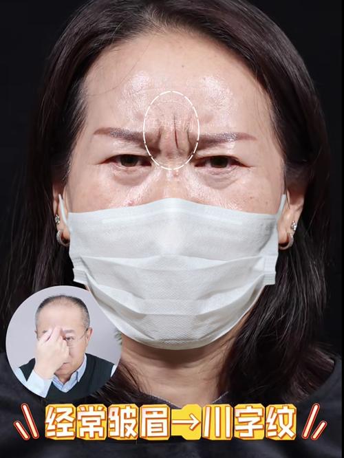 为什么有些坏习惯会让我的面部加速衰老？