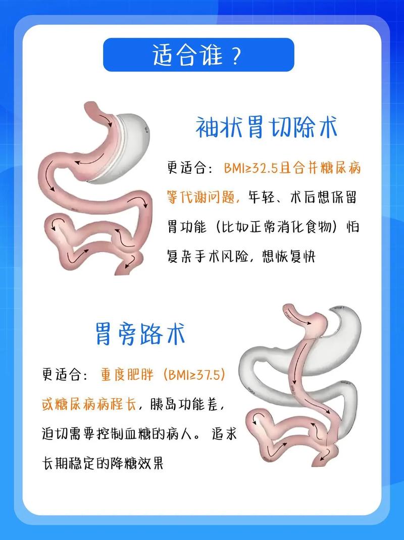 胃旁路手术减肥成功的关键是否在于高超的外科技术？