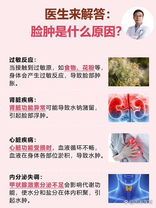 为什么我经常会有脸部浮肿，是不是因为四大坏习惯导致的呢？