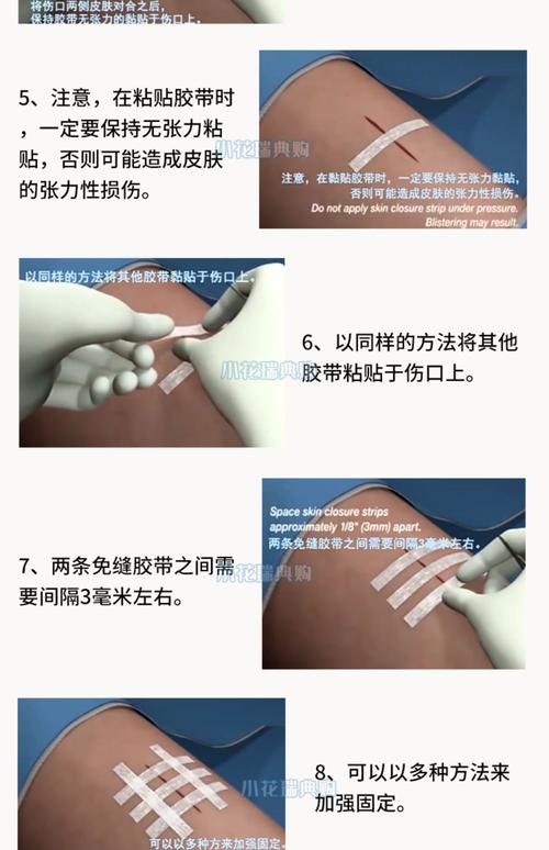 胶带真的能帮助我快速减肥吗？