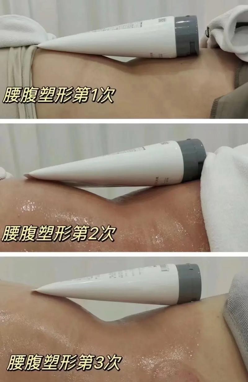 今夏如何通过手术减肥塑身，打造全新形象？