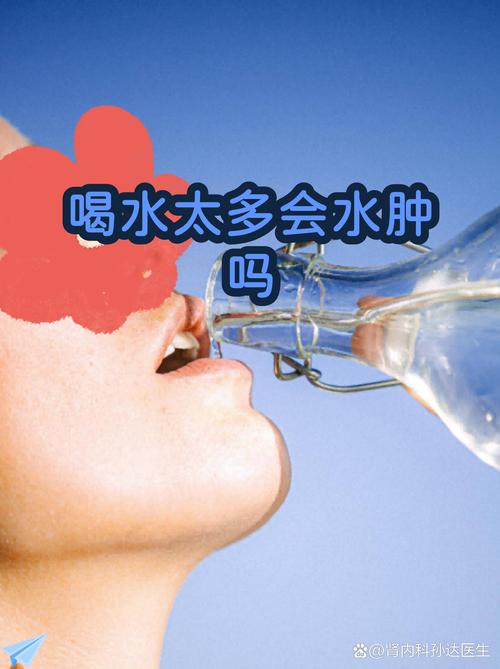 大量饮水会导致身体出现浮肿现象吗？