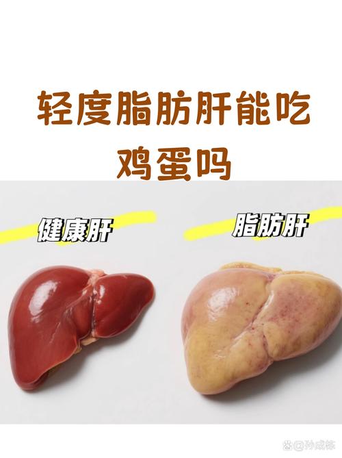 蛋黄中隐藏的脂肪成分，是不是一种不易察觉的肥肉呢？