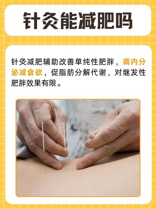 针灸减肥一个月能减掉14斤吗？效果如何？