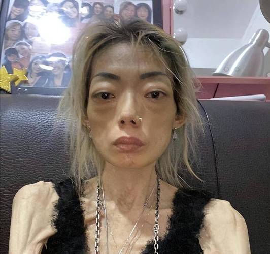 过度减肥导致美女变成干尸，这种极端减肥方法真的安全吗？