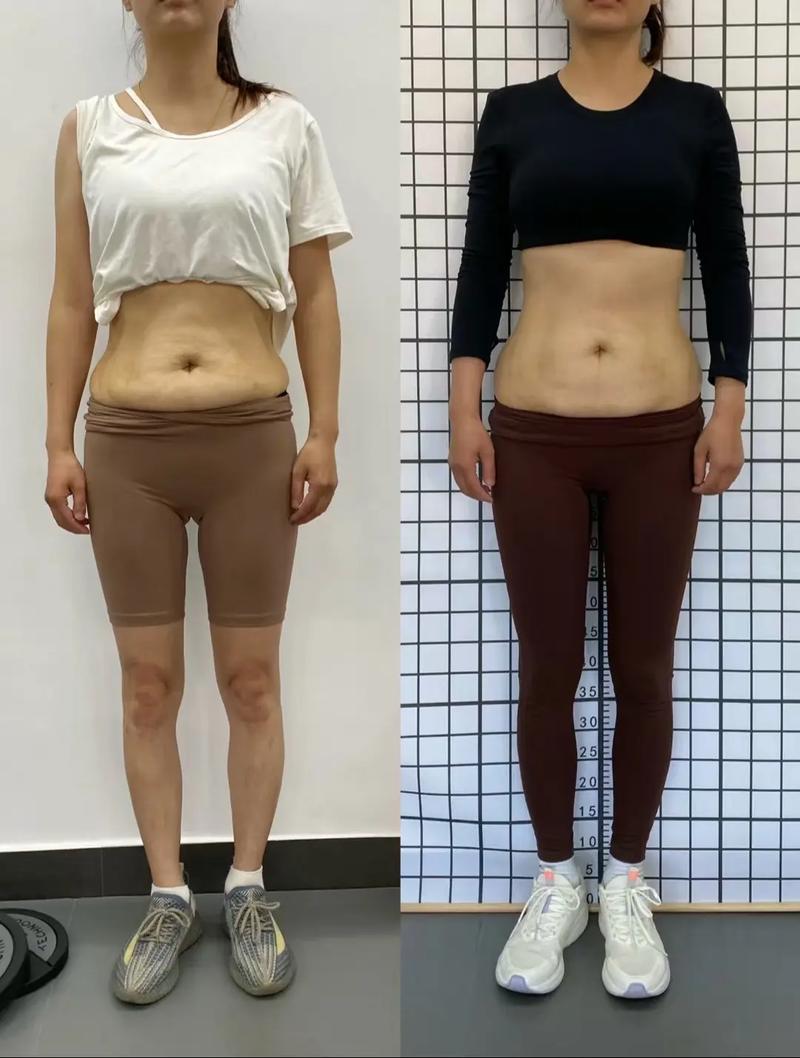 女子快速减肥后皮肤松弛，如何通过举重健身重拾自信？