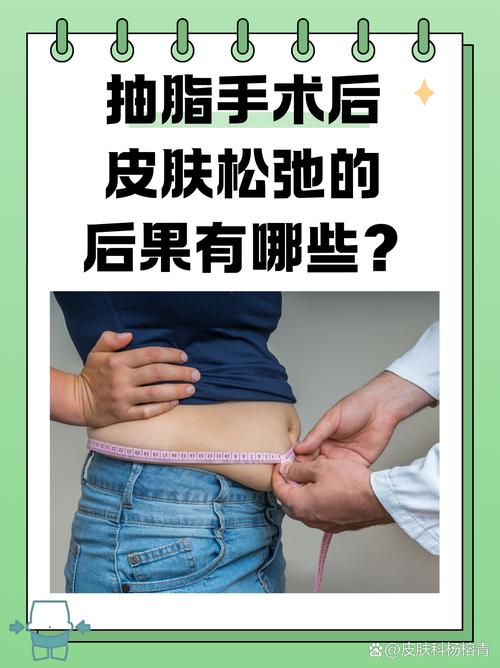 吸脂后皮肤会松弛下垂吗？有没有方法避免？