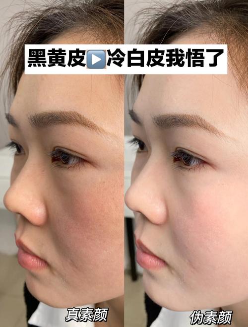 哪种瘦脸霜涂抹后效果最好？