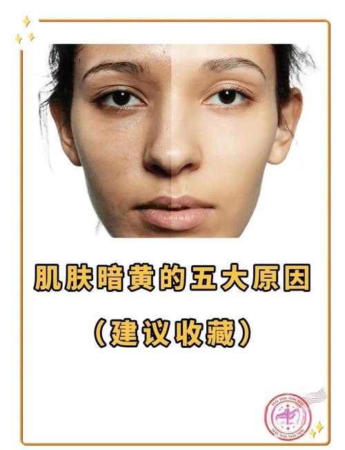 新疆女士服用后全身皮肤变黄是什么原因？