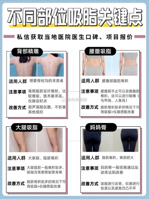 激光抽脂减肥有哪些显著优势？