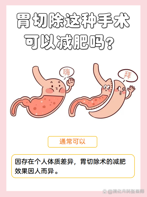 胃肠减肥手术风险高，拿生命开玩笑真的值得吗？