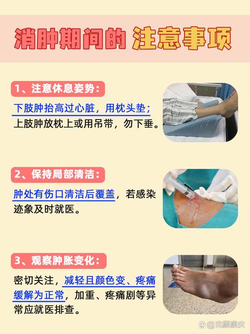 如何通过小妙招有效消除水肿手臂问题？