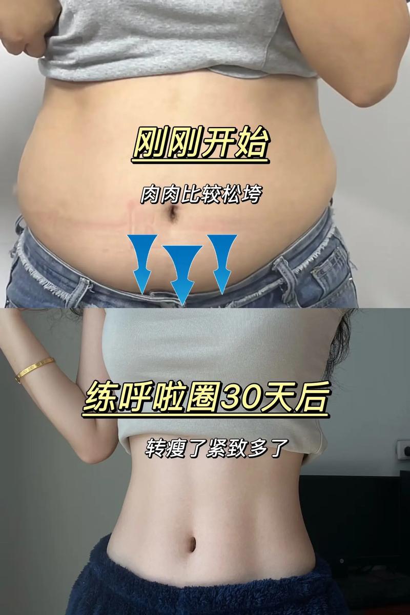如何通过腹部吸脂轻松摆脱游泳圈困扰？