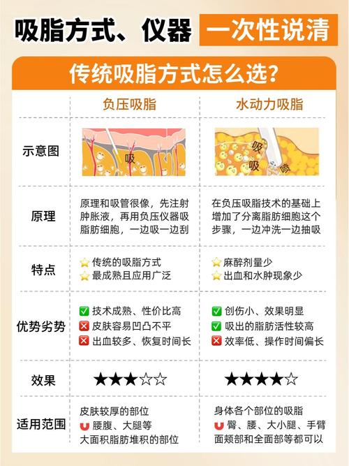 脂肪抽吸术有哪些不同的抽吸方法？